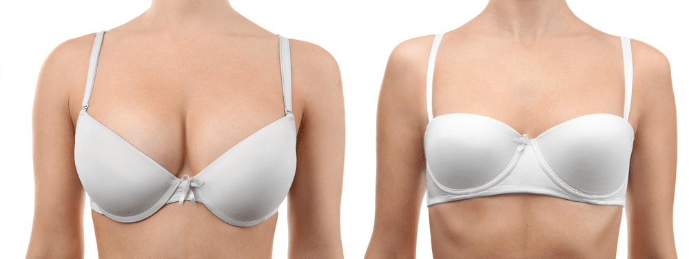 How Many Sizes Can You Go Down in a Breast Reduction 637378223337906540