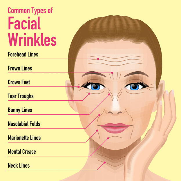 facial wrinkles sydney