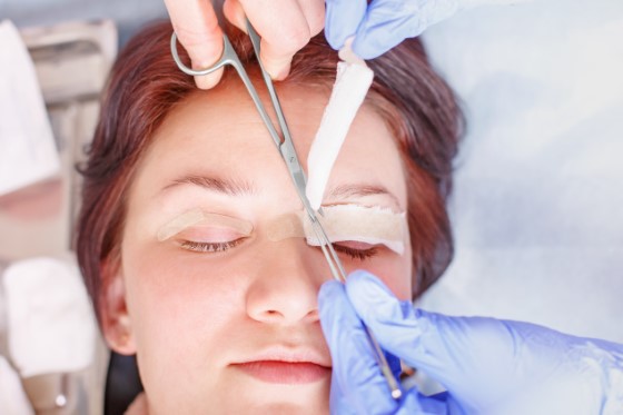 eyelid surgery in central coast - My Cosmetic Clinic