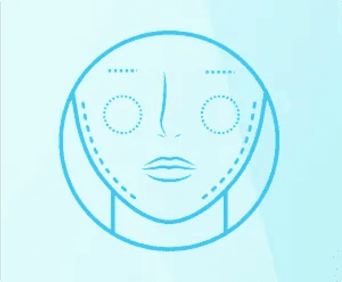 Wrinkle Injections Sydney